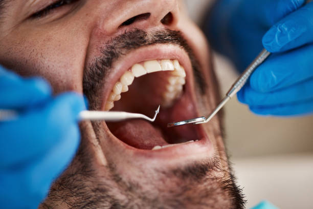 Best Pediatric Emergency Dentist in Dresden, OH